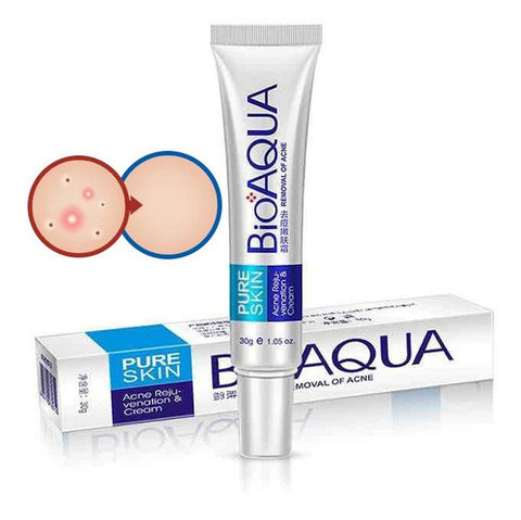 Cuídate Bien Kit Facial Antiacné - Mega Tienda